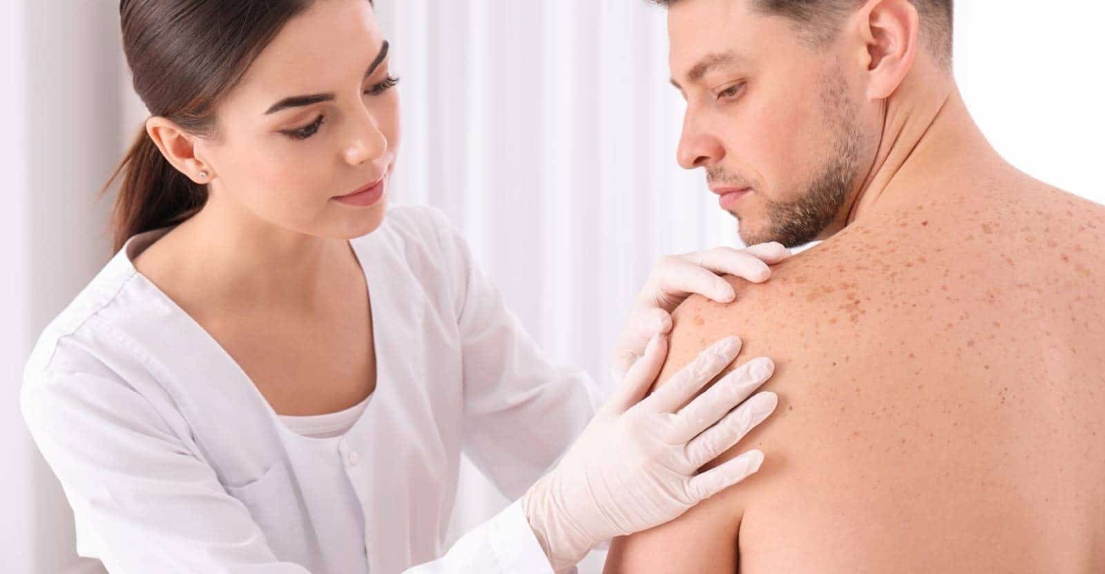 Psoriasis Doctor