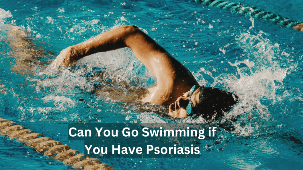 can i go swimming with psoriasis can i go swimming with psoriasis