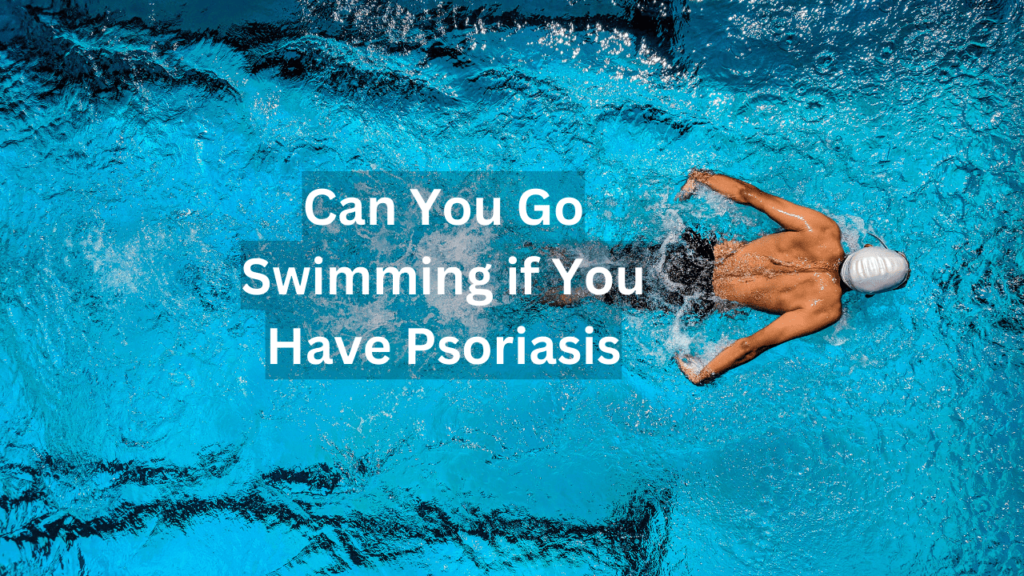 can you go swimming if you have psoriasis can you go swimming if you have psoriasis