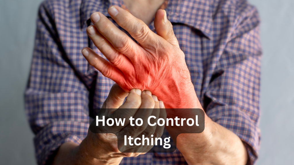 How to Stop Psoriasis Itching